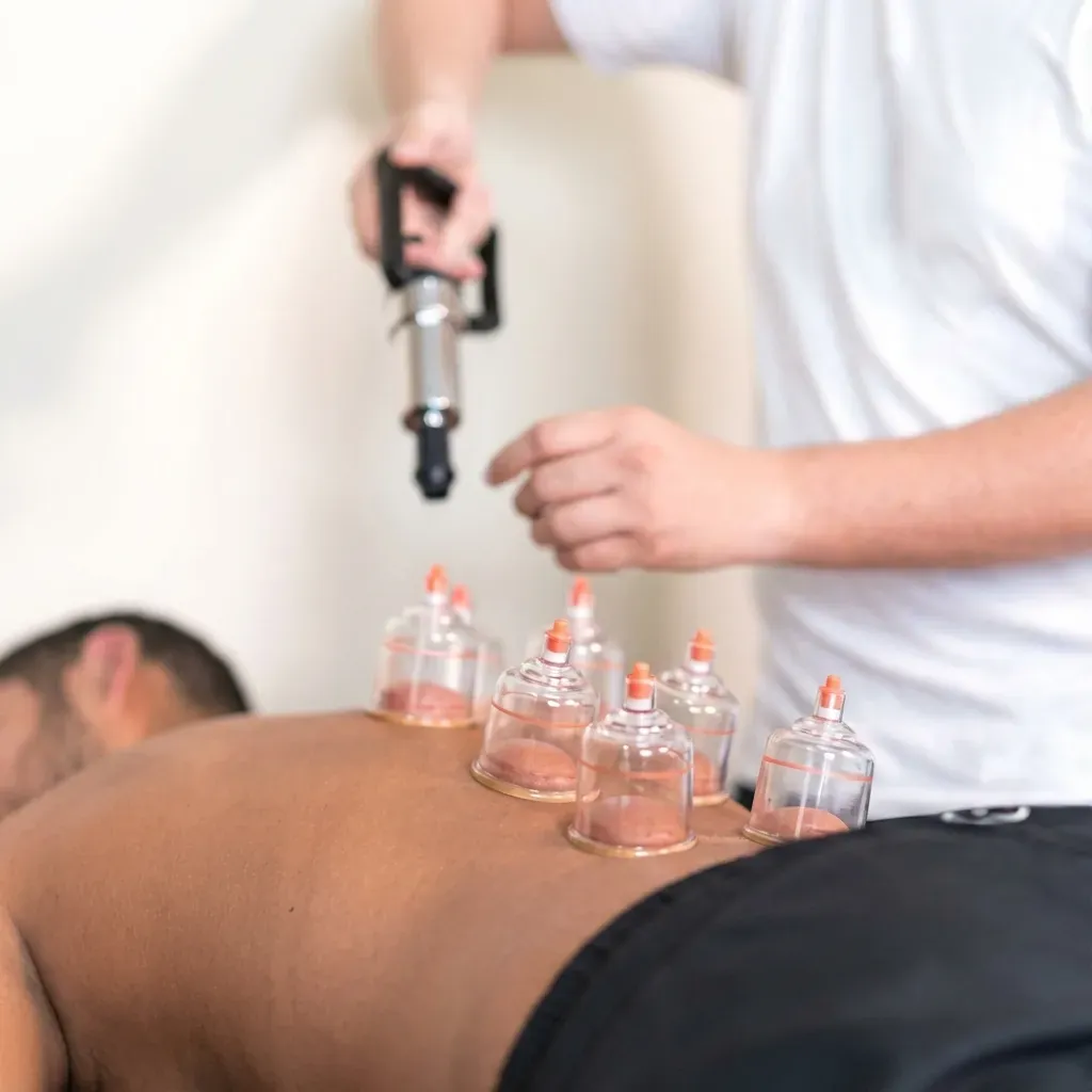 Cupping thérapie Paris 12