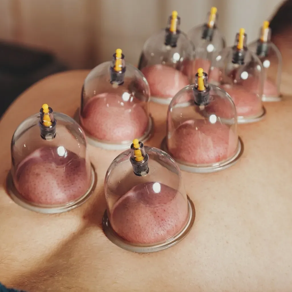 Séance de cupping professionnelle
